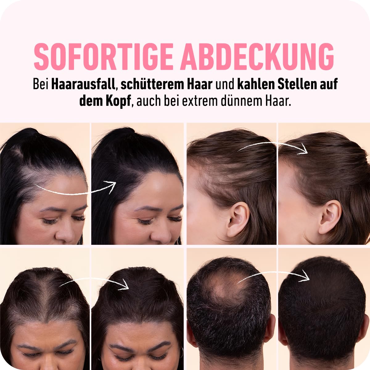 Ansatzpuder zur Haarverdichtung und Grauabdeckung, 4 g (1er Pack) Aschbraun